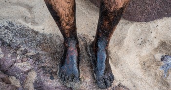 Negligência e sigilo do Governo Bolsonaro expõem saúde dos voluntários que limpam óleo das praias (crédito: Inês Campelo/MZ Conteúdo)