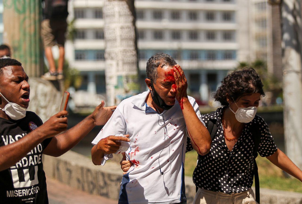 Daniel Campelo da Silva, 51 anos, morador dos Torrões, zona oeste do Recife, foi uma das pessoas violentamente atingidas pelo Batalhão de Choque da Polícia Militar de Pernambuco