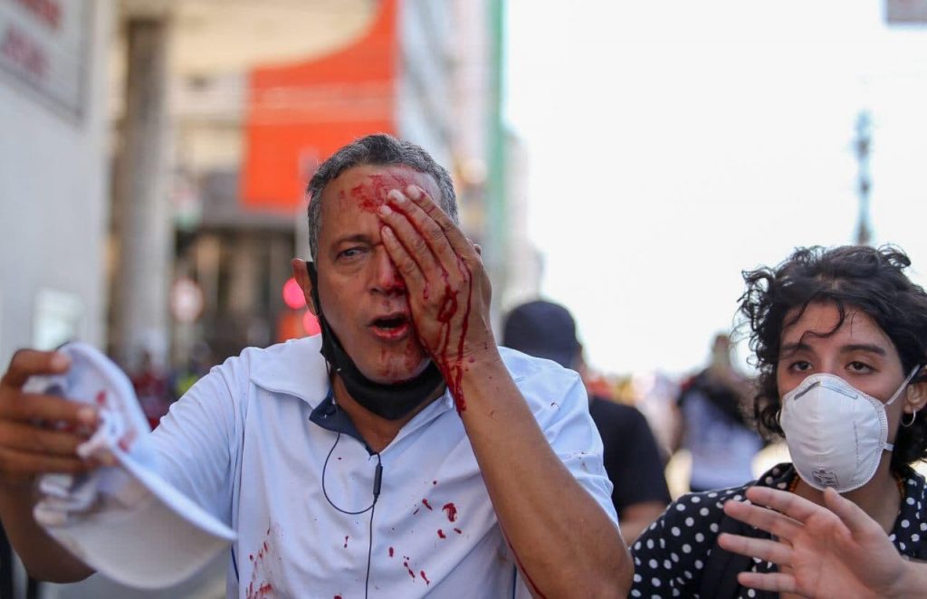 Foto de um homem branco de meia idade e cabelos curtos, com as mãos ensanguentadas tapando o olho esquerdo. À direita, está a advogada Isabela Freitas, jovem morena, de cabelos encaracolados despenteados, usando uma máscara cirúrgica e uma blusa preta com bolinhas brancas.