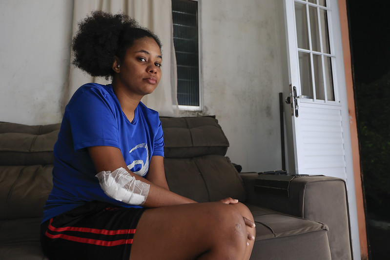 Uma jovem negra, vestida de blusa azul e short preto com listras vermelhas, com um curativo no cotovelo. Ela está sentada em um sofá cinza em uma sala de estar.